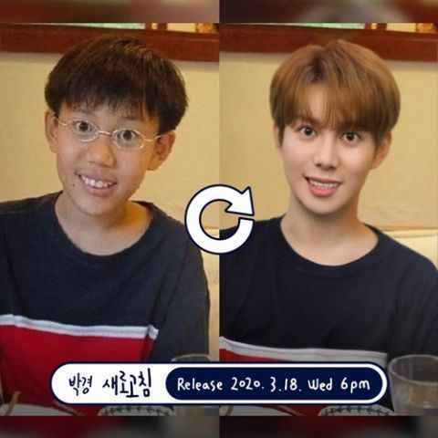 《麻浦小帅哥》宋旻浩、P.O公开童年照,还表示:曲名应该要叫做「世路刷新」