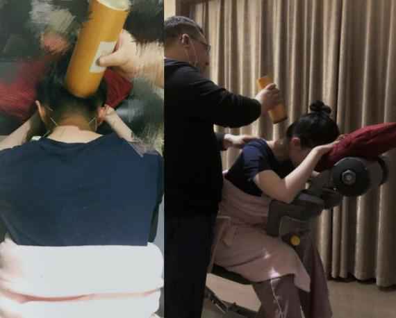 颈椎病复发?刘亦菲晒做针灸图