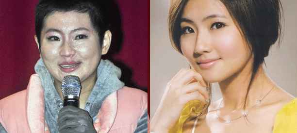 满满的恶意!Selina露伤疤被骂博同情