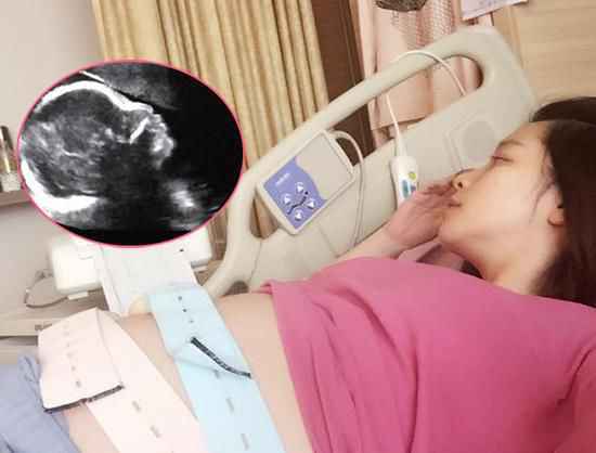 40岁徐若瑄怀孕27周需别人倒尿擦澡 称讨厌自己