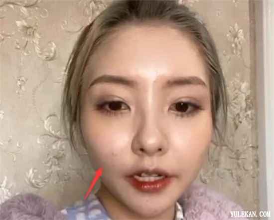 王思聪前女友豆得儿关了美颜脸上全是痘为何又开直播?