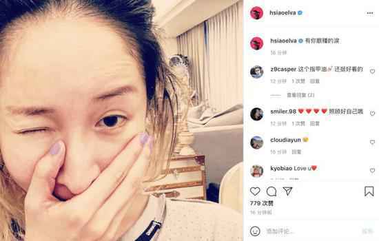 萧亚轩深夜晒素颜自拍 用手捂脸似在遮伤口