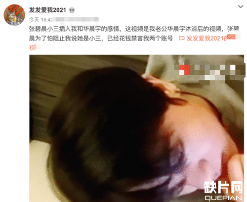 华晨宇出轨且整容是真的吗？华晨宇整容前照片曝光